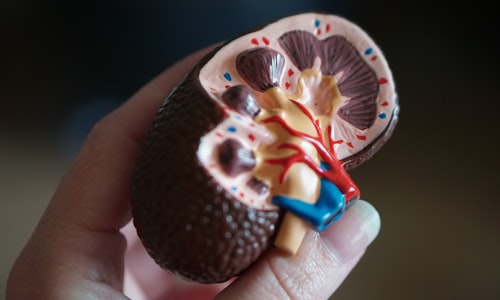 kidney transplants facts