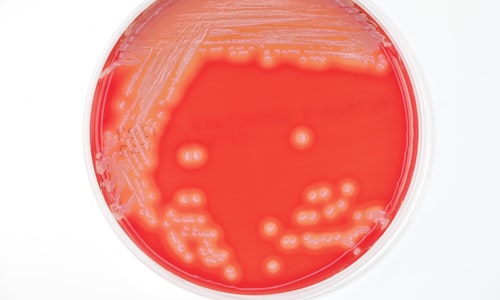 staphylococcus aureus facts