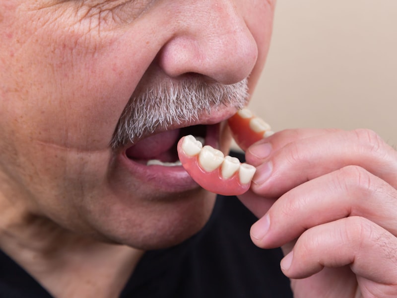 Dental Implants - Why Should I Get Dentures?